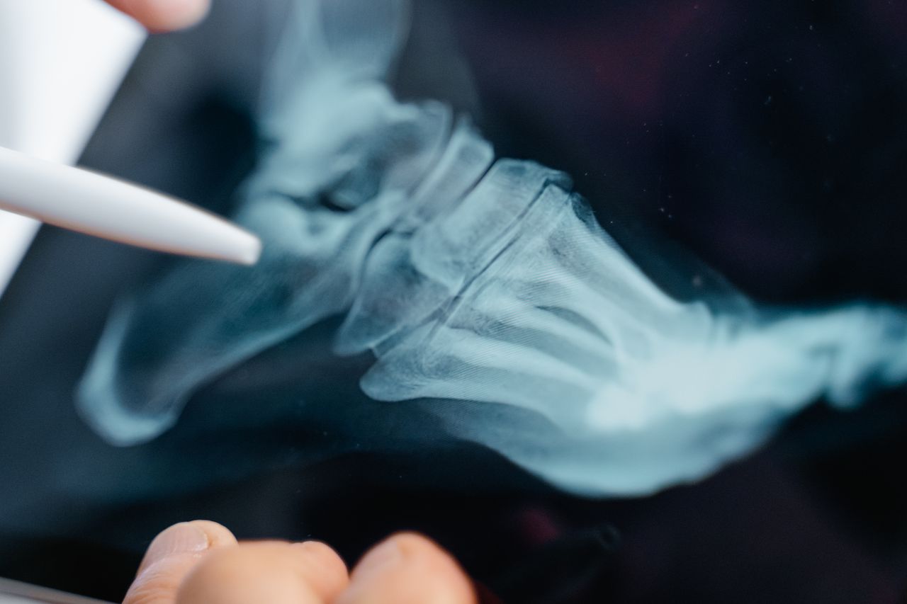 about-us Detailed close-up of a foot x-ray displayed on a digital tablet screen.
